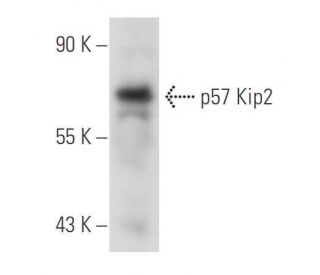 western blotting image from recommended p57 Kip2 (KP39) monoclonal antibody replacement. Image 44027