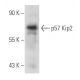 This polyclonal antibody has been discontinued. See our recommended <a href="p57-antibody-kp39">p57 Kip2 (KP39)</a> monoclonal antibody (sample data shown). western blotting image from recommended p57 Kip2 (KP39) monoclonal antibody replacement. Image 44027
