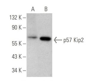 p57 Kip2 Antibody (SPM308) - Western Blotting - Image 353698