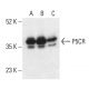 P5CR Antibody (A-12) - Western Blotting - Image 402275 
