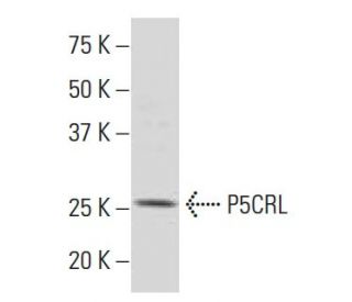 P5CRL Antibody (E-63) - Western Blotting - Image 33858Each CRISPR/Cas9 Knockout (KO) Plasmid product consists of a pool of 3 plasmids designed to ensure identification and cleavage of a specific gene for maximum knockout efficiency. Each plasmid encodes a unique 20 nt sequence derived from the GeCKO (v2) library. 