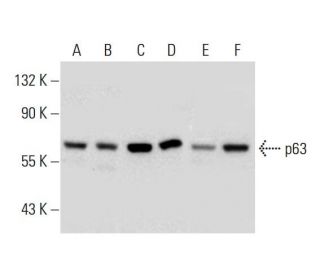 p63 Antibody (D-9) - Western Blotting - Image 130007 