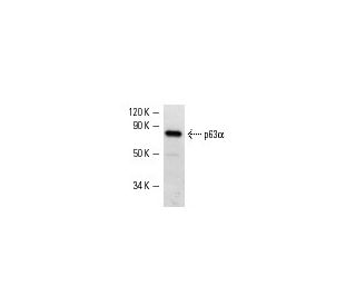 p63&alpha; Antibody (C-12) - Western Blotting - Image 21 