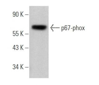 western blotting image from recommended p67-phox (D-6) monoclonal antibody replacement. Image 363437