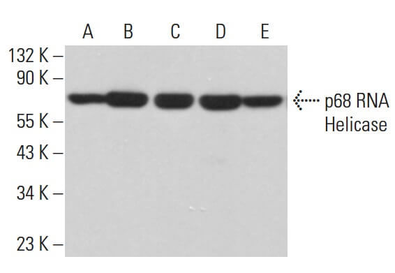 BRCA2 promotes DNA‐RNA hybrid resolution by DDX5 helicase at DNA