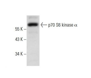 p70 S6 kinase/S6K1 Antibody (B-5) - Western Blotting - Image 300631 