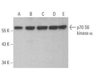 western blotting image from recommended p70 S6 kinase/S6K1 (H-9) monoclonal antibody replacement. Image 353331