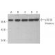 Este anticorpo policlonal foi descontinuado. Consulta o nosso anticorpo monoclonal <a href="p70-s6-kinase-alpha-antibody-h-9">p70 S6 kinase/S6K1 (H-9)</a> recomendado (dados de amostra apresentados). western blotting image from recommended p70 S6 kinase/S6K1 (H-9) monoclonal antibody replacement. Image 353331
