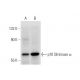 p70 S6 kinase/S6K1 Antibody (D-4) - Western Blotting - Image 320894 