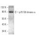 p70 S6 kinase/S6K1 Antibody (D-4) - Western Blotting - Image 380611