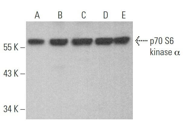 スーパーセール期間限定 S6 p70 kinase/S6K1 Cruz Santa - SCBT | (H-9) Antibody その他