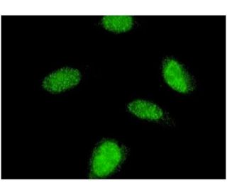 immunofluorescence image from recommended p70 S6 kinase &beta; (4B11) monoclonal antibody replacement. Image 346124