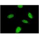 immunofluorescence image from recommended p70 S6 kinase β (4B11) monoclonal antibody replacement. Image 346124