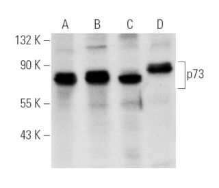 western blotting image from recommended p73 (E-4) monoclonal antibody replacement. Image 27