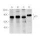 western blotting image from recommended p73 (E-4) monoclonal antibody replacement. Image 27