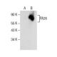 PA26 Antibody (C-10) - Western Blotting - Image 154504