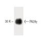 PA28γ Antibody (47) - Western Blotting - Image 60401 