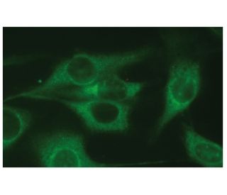 immunofluorescence image from recommended PABP (A-4) monoclonal antibody replacement. Image 114121