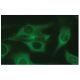 This polyclonal antibody has been discontinued. See our recommended <a href="pabp-antibody-a-4">PABP (A-4)</a> monoclonal antibody (sample data shown). immunofluorescence image from recommended PABP (A-4) monoclonal antibody replacement. Image 114121