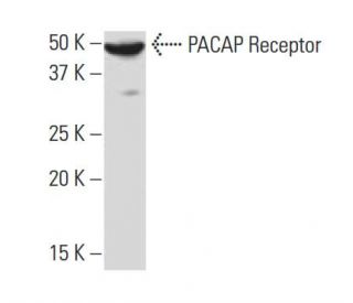 western blotting image from recommended PACAP Receptor (1B5) monoclonal antibody replacement. Image 33691