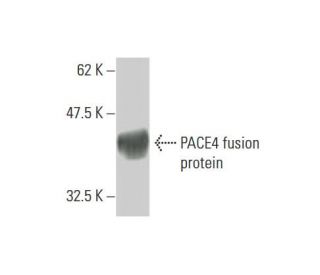 PACE4 Antibody (2D6) - Western Blotting - Image 348558