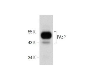 PAcP Antibody (C-12) - Western Blotting - Image 289846