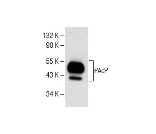 PAcP Antibody (PAP-1) - Western Blotting - Image 286733 