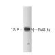 PACS-1a Antibody (4) - Western Blotting - Image 133212 