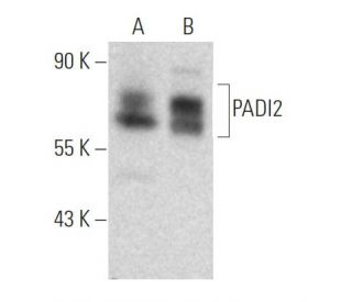 PADI2 Antibody (4D4): sc-293271