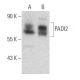 PADI2 Antibody (4D4) - Western Blotting - Image 367983 