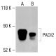 PADI2 Antibody (4D4) - Western Blotting - Image 414181 