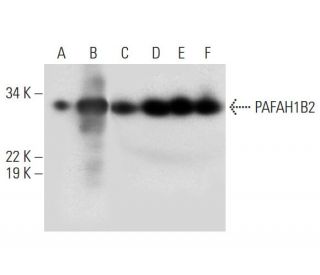 PAFAH1B2 Antibody (A-6) - Western Blotting - Image 292979 