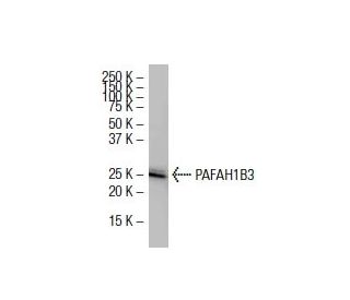 PAFAH1B3 Antibody (37-K) - Western Blotting - Image 33600 