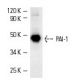 western blotting image from recommended PAI-1/SERPINE1 (C-9) monoclonal antibody replacement. Image 3496