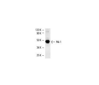 western blotting image from recommended PAI-1/SERPINE1 (C-9) monoclonal antibody replacement. Image 3496