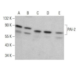 western blotting image from recommended PAI-2 (E-1) monoclonal antibody replacement. Image 381355