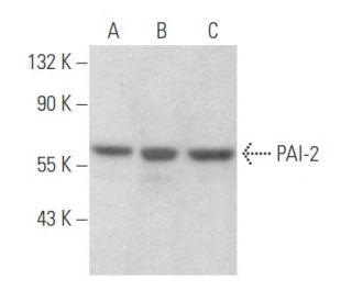 PAI-2 Antibody (E-1) - Western Blotting - Image 356044The Double Nickase Plasmid features a U6 promoter for sgRNA expression, a 20 nt targeting sequence, and a gRNA scaffold to guide Cas9n. It includes a CBh promoter for Cas9n (D10A) and puromycin resistance, GFP for transfection verification, and nuclear localization signals (NLS). The 2A peptide allows co-expression of Cas9n and Puro from a single promoter, enabling precise genome editing with reduced off-target effects.