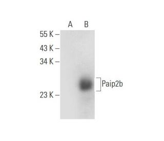 Paip2b Antibody (E-9) - Western Blotting - Image 314071