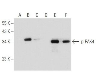 PAK4 Antibody (6C1) - Western Blotting - Image 133114 