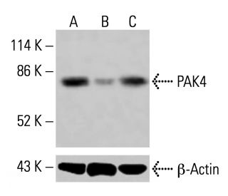 PAK4 Antibody (B-3) - Western Blotting - Image 415085 