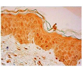 immunohistochemistry image from recommended PAK6 (H-6) monoclonal antibody replacement. Image 313246