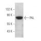 PAL Antibody (E-9) - Western Blotting - Image 369020 