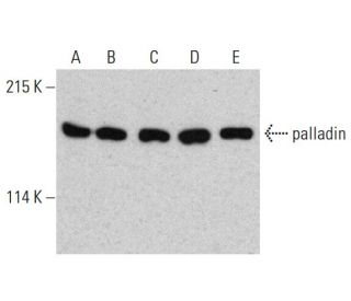 palladin Antibody (E-6) - Western Blotting - Image 386877 