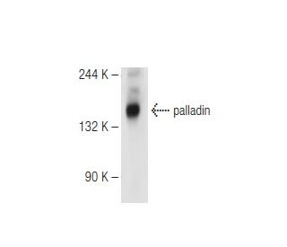 palladin Antibody (G-2) - Western Blotting - Image 84094 