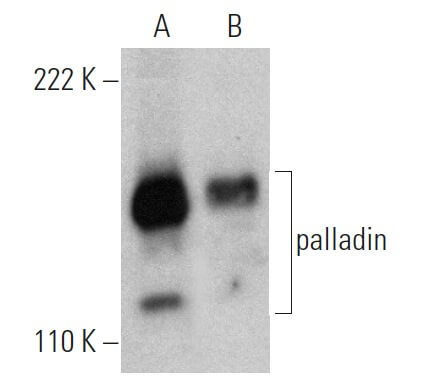 nabe190 13枚 palladin抗体(G-2) | SCBT - Santa Cruz Biotechnology