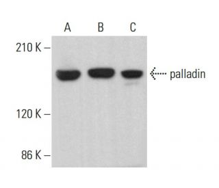 palladin Antibody (E-6) - Western Blotting - Image 380747 