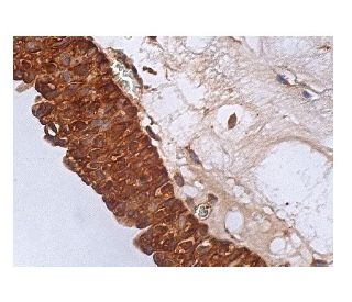 B●scientifica　306-14-4 Amazon.com: JEENDA Wheel Motor for Exmark Lazer Z 1-523328