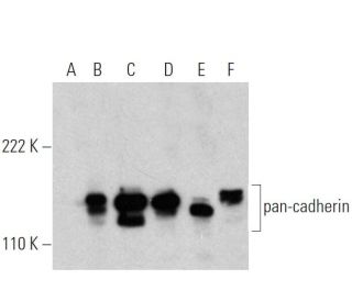 pan-cadherin Antibody (E-11) - Western Blotting - Image 370513 