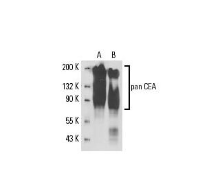 pan CEA Antibody (161) - Western Blotting - Image 17611 