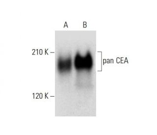 pan CEA Antibody (B-1) - Western Blotting - Image 304509